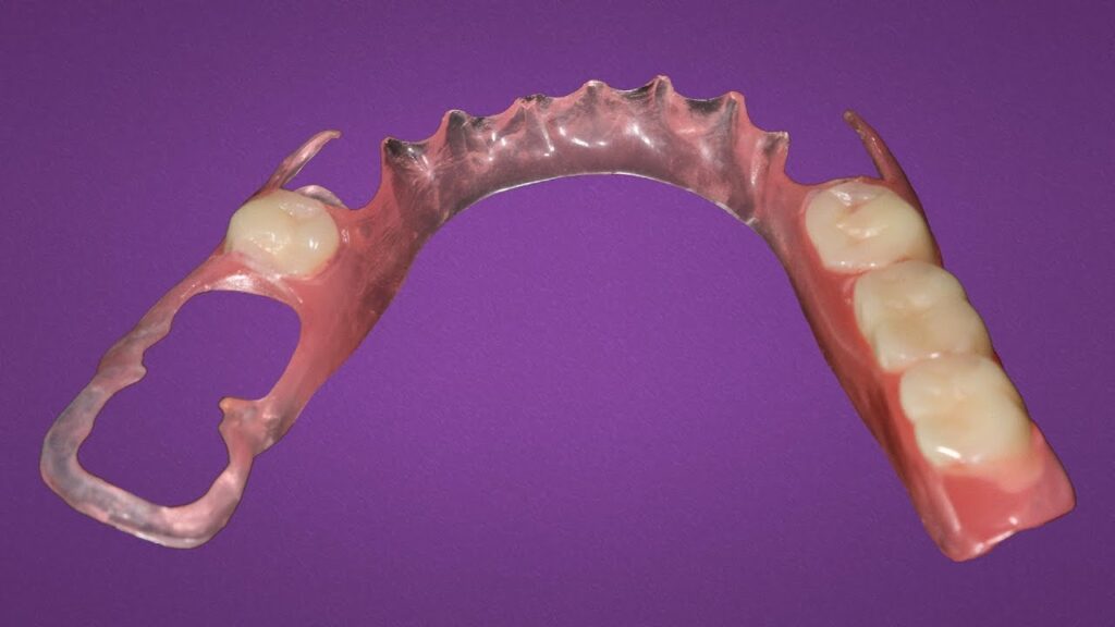 Flexible partial dentures